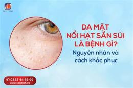 tính năng nổi bật da mặt bị nổi sần như da gà