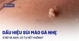 tính năng nổi bật đốt sùi mào gà ở bệnh viện da liễu webtretho