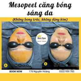 tính năng nổi bật gậy đánh bóng chày