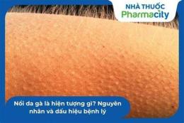 tính năng nổi bật hiện tượng nổi da gà là biểu hiện của hiện tượng