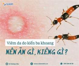 tính năng nổi bật kiến ba khoang gây viêm da