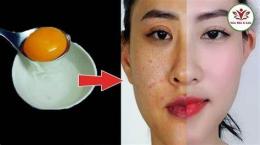 tính năng nổi bật làm trắng da mặt với trứng gà