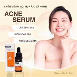 tính năng nổi bật mụn đầu đen gần