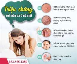 tính năng nổi bật nguyên nhân dẫn đến sự đa dạng mào ở gà
