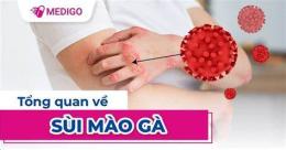tính năng nổi bật sui mao ga o da