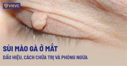 tính năng nổi bật sùi mào gà trên da mặt
