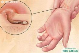 tính năng nổi bật tay nổi da gà ngứa