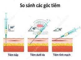 tính năng nổi bật tiêm dưới da gà