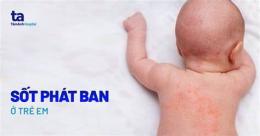 tính năng nổi bật trẻ em sốt nổi da gà
