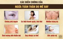 tính năng nổi bật triệu chứng ớn lạnh nổi da gà