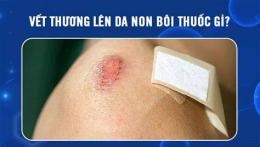 tính năng nổi bật vết thương lên da non ăn gà được không