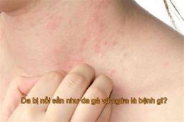 tính năng nổi bật vùng cổ bị nổi da gà