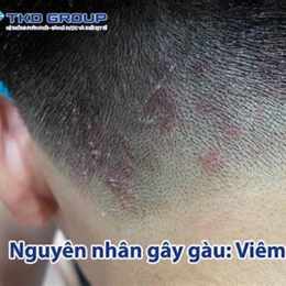 tình trạng da gà