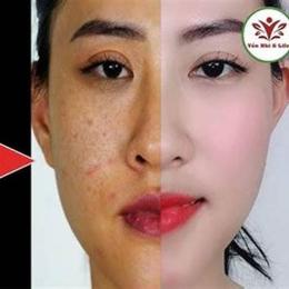 trắng da với lòng trắng trứng gà