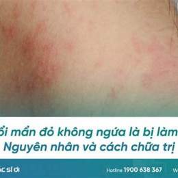 triệu chứng ớn lạnh nổi da gà