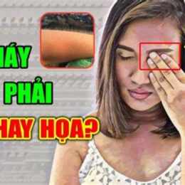 tự dưng nổi da gà