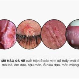 xem mào gà đá